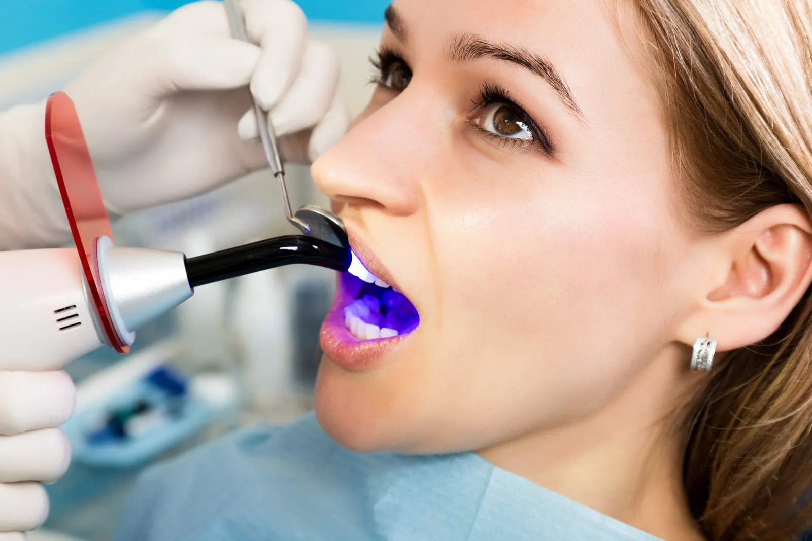Dental bonding treatment at Gentle Dental in Charlotte MI