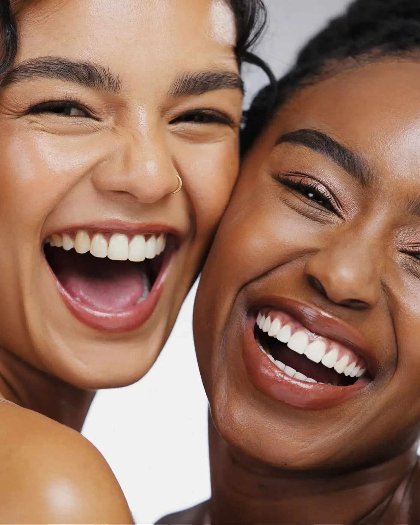 Porcelain veneer consultation at Gentle Dental