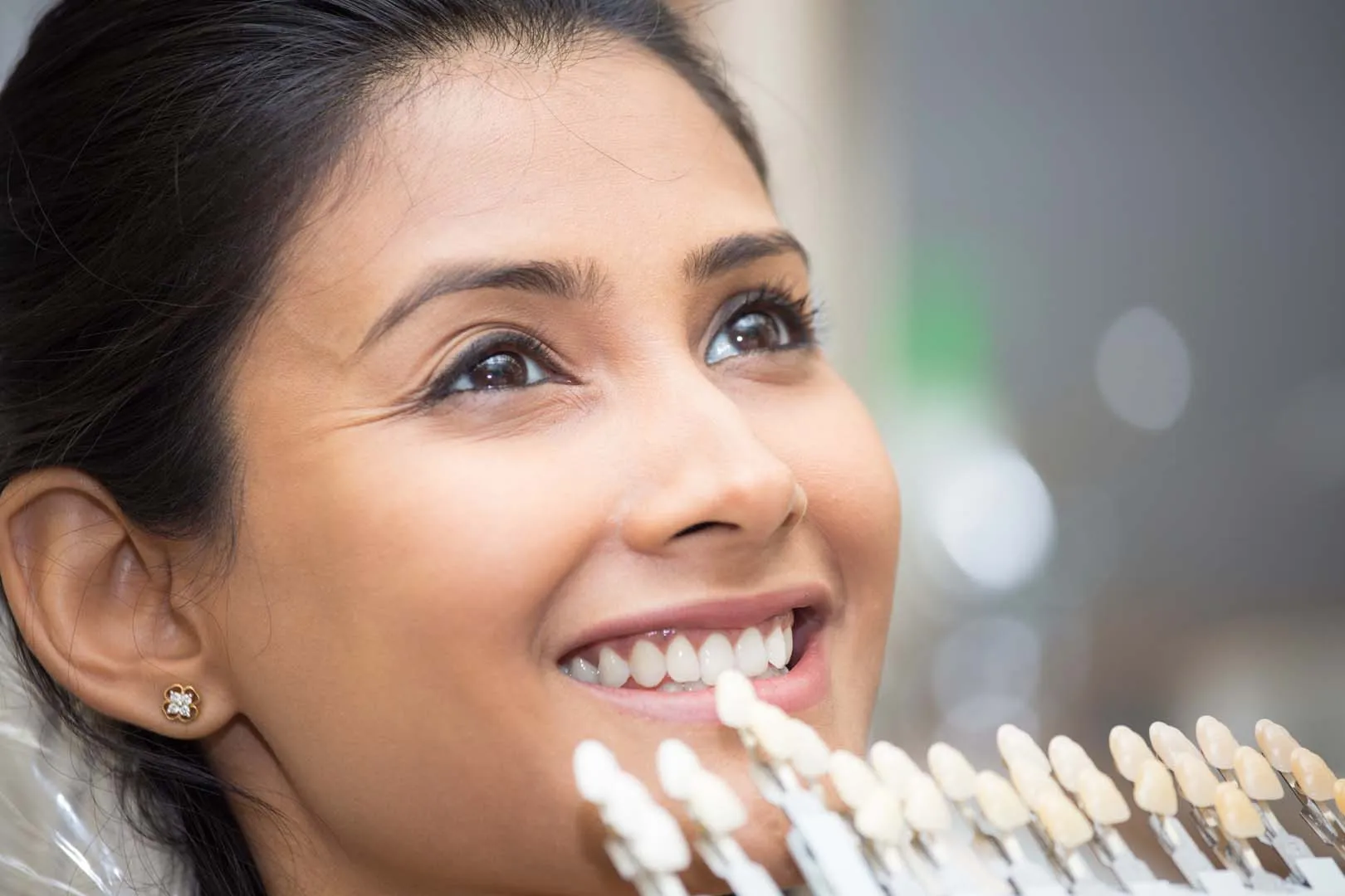 Snap-On Smile removable veneer option at Gentle Dental